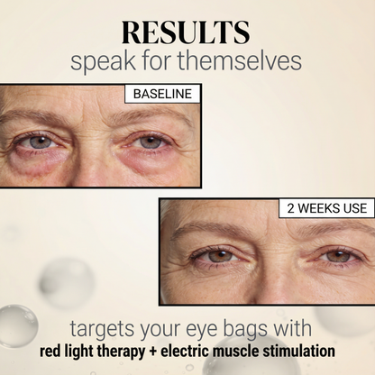 Eye Rejuvenation Light Therapy