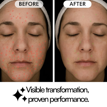 Studio Dermal® Peptide Infusion Kit